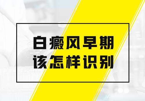 宁波哪里白癜风 白癜风有什么症状